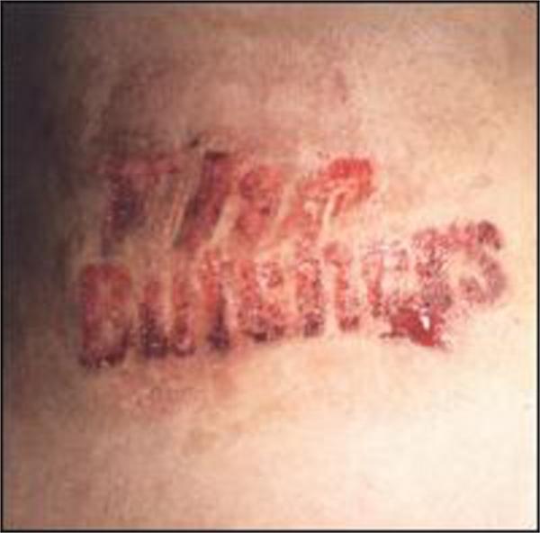 Flesh Eating Twist CD